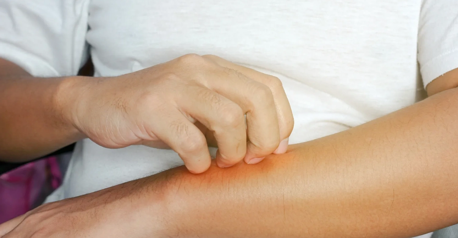 Tick Borne Diseases and Oral Health INBLOG